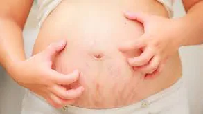 Tinh bột nghệ cho chị em sau khi sinh.